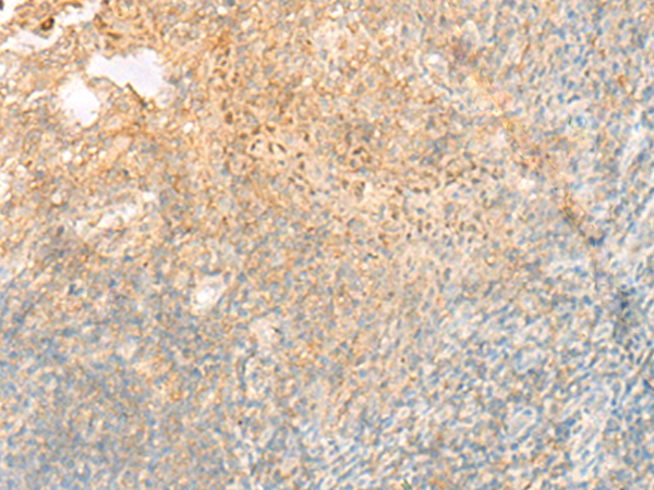 Rabbit Polyclonal Antibody to PROKR1