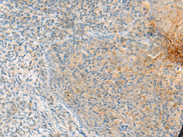 Rabbit Polyclonal Antibody to PROKR2