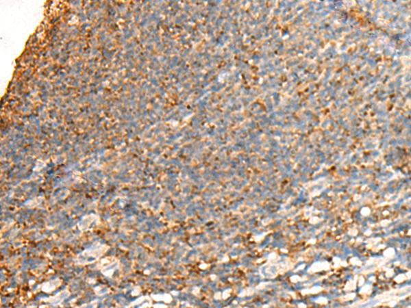 Rabbit Polyclonal Antibody to GPSM2