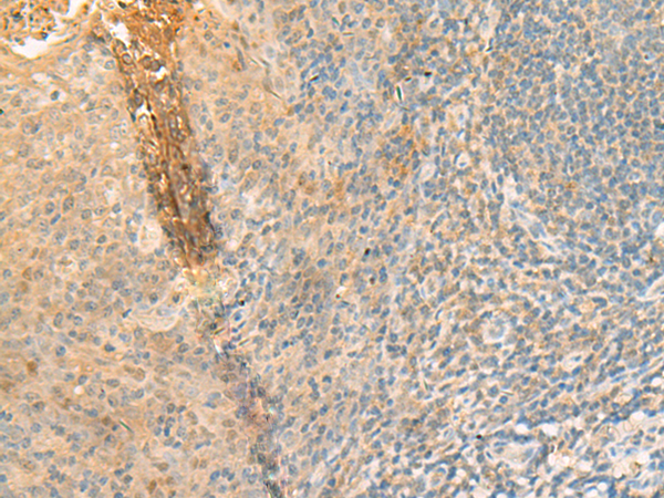 Rabbit Polyclonal Antibody to GPT2
