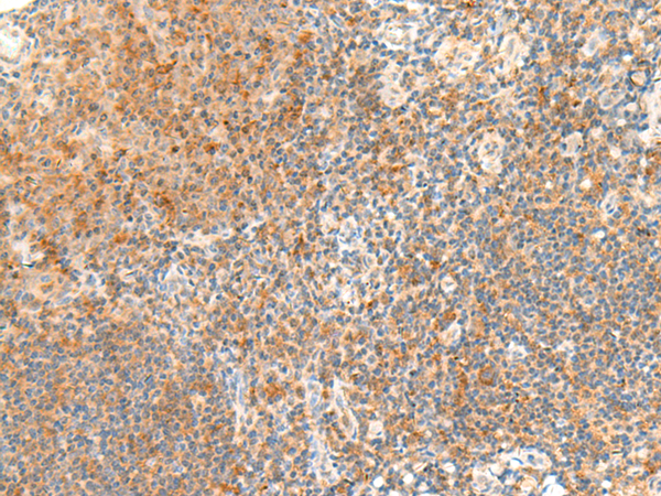 Rabbit Polyclonal Antibody to RAPGEF1