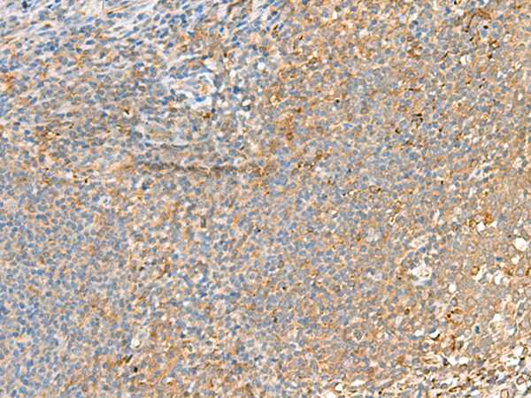 Rabbit Polyclonal Antibody to GRIK2