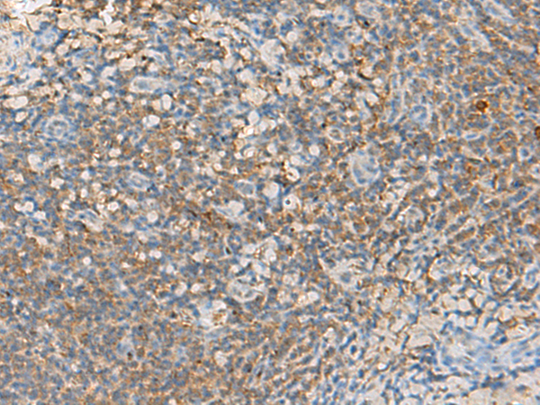 Rabbit Polyclonal Antibody to GRIK5