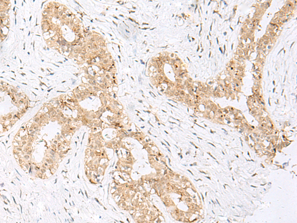 Rabbit Polyclonal Antibody to GSC