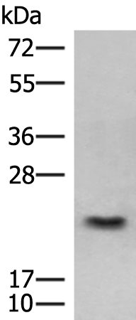 Rabbit Polyclonal Antibody to GSTM2