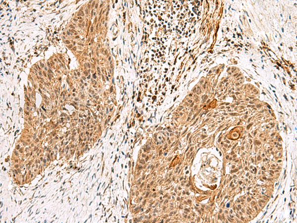 Rabbit Polyclonal Antibody to GTF2H4