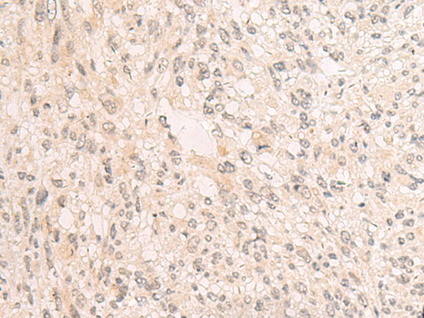 Rabbit Polyclonal Antibody to GTF3C3