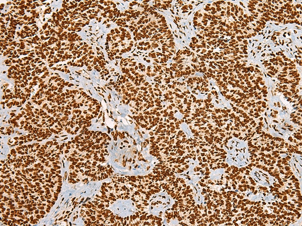 Rabbit Polyclonal Antibody to HABP4