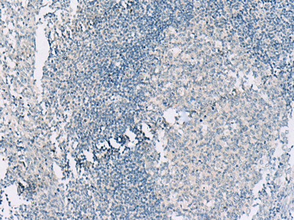 Rabbit Polyclonal Antibody to HASPIN