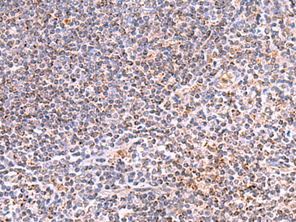 Rabbit Polyclonal Antibody to HSF2BP