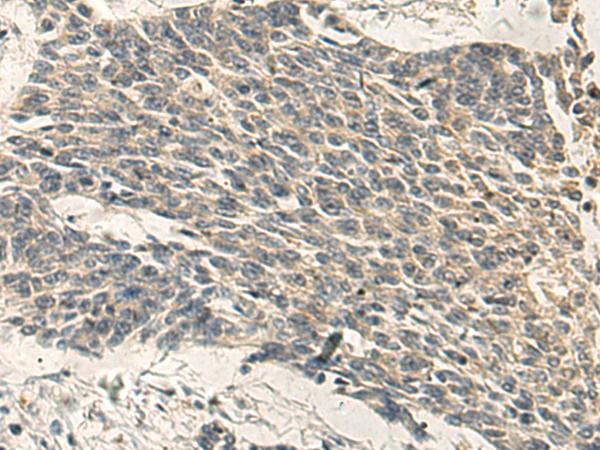 Rabbit Polyclonal Antibody to PRKCH