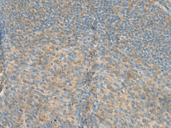 Rabbit Polyclonal Antibody to GNGT2
