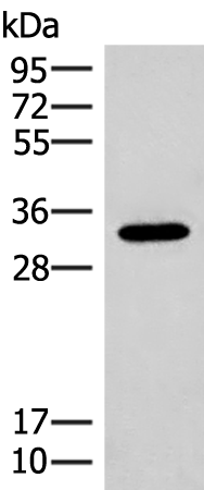 Rabbit Polyclonal Antibody to RGR