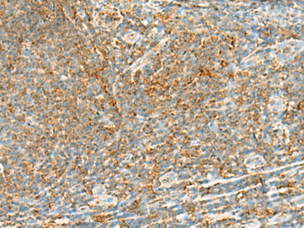 Rabbit Polyclonal Antibody to EDEM3