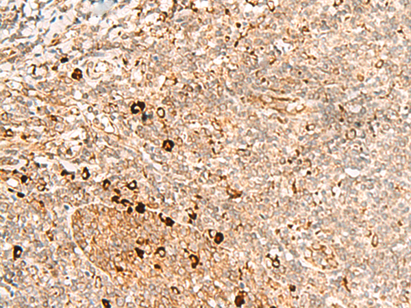 Rabbit Polyclonal Antibody to EOGT