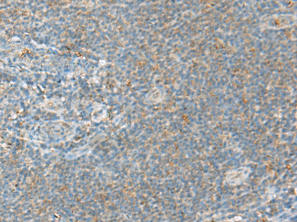 Rabbit Polyclonal Antibody to HECA