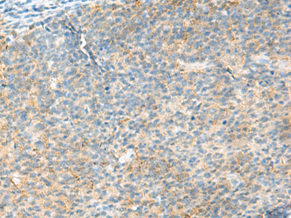 Rabbit Polyclonal Antibody to HECTD1