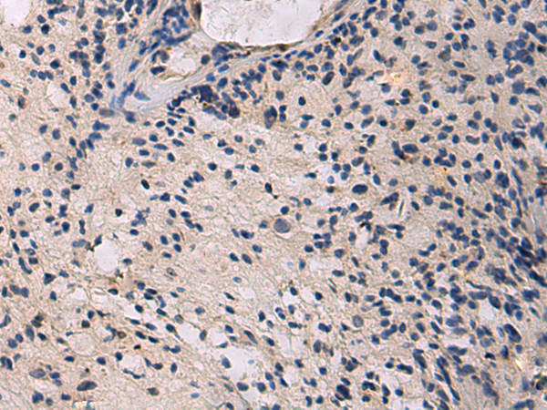 Rabbit Polyclonal Antibody to HECTD2