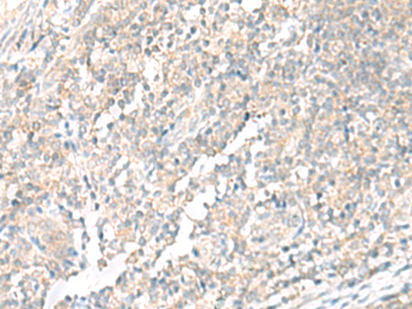 Rabbit Polyclonal Antibody to ERI1