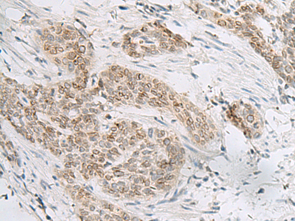 Rabbit Polyclonal Antibody to HHLA2