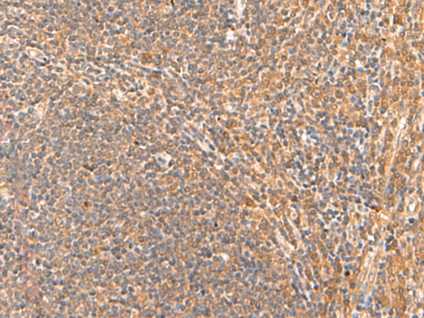 Rabbit Polyclonal Antibody to HPCA