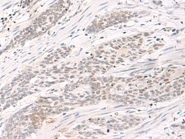 Rabbit Polyclonal Antibody to H1-3