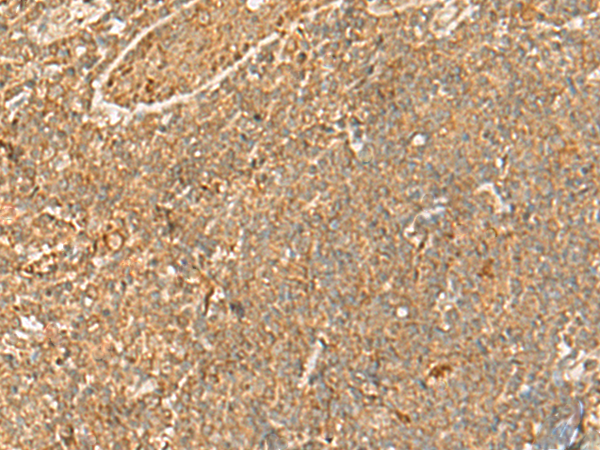 Rabbit Polyclonal Antibody to H1-8