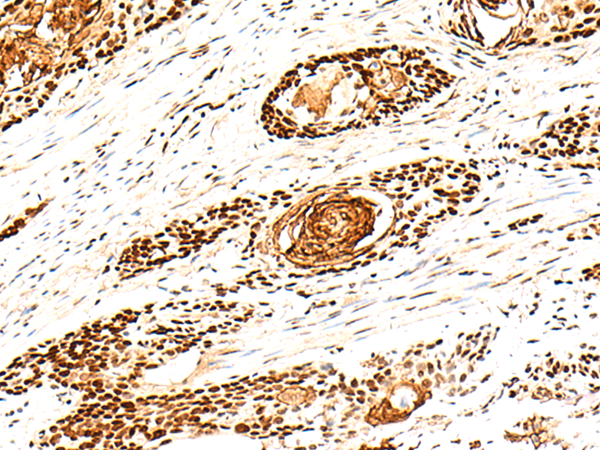 Rabbit Polyclonal Antibody to H1-10