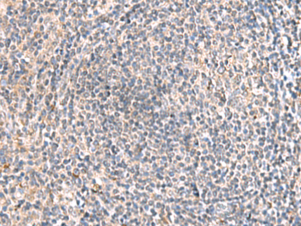 Rabbit Polyclonal Antibody to HLA-DOB