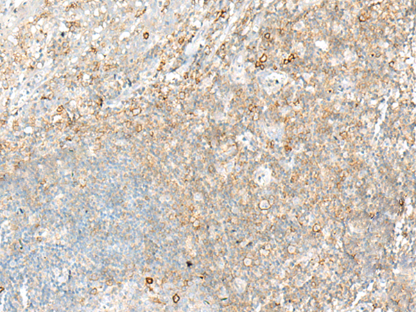 Rabbit Polyclonal Antibody to HLA-DRB1