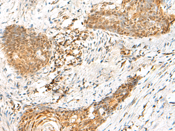 Rabbit Polyclonal Antibody to HMBOX1