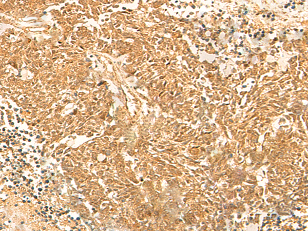 Rabbit Polyclonal Antibody to KRT76