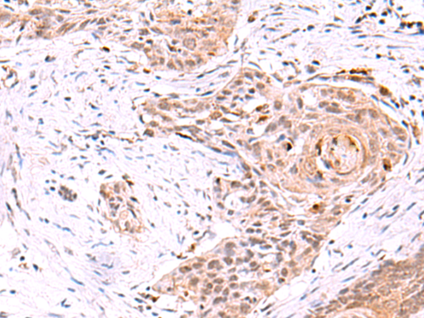 Rabbit Polyclonal Antibody to HNF4A