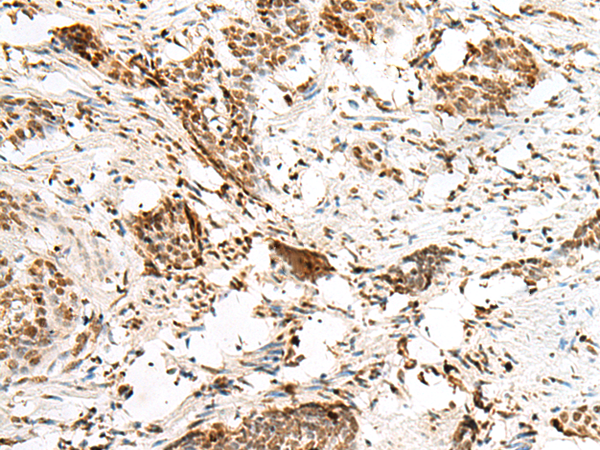 Rabbit Polyclonal Antibody to HNRNPCL1