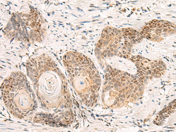Rabbit Polyclonal Antibody to TLX1
