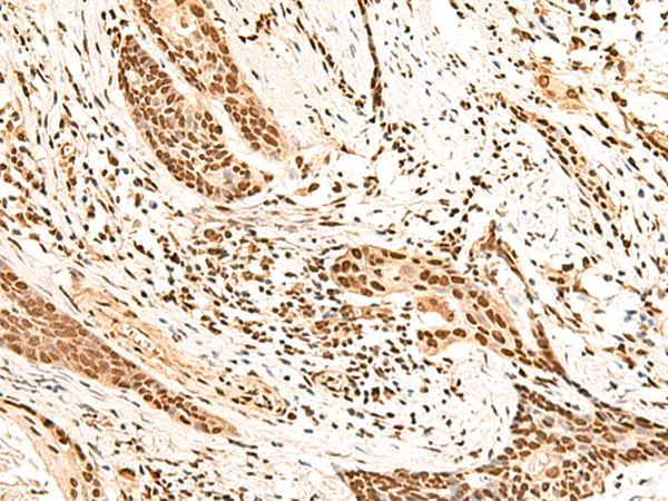 Rabbit Polyclonal Antibody to HOXC13
