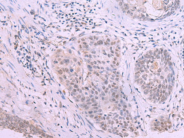 Rabbit Polyclonal Antibody to HOXD4