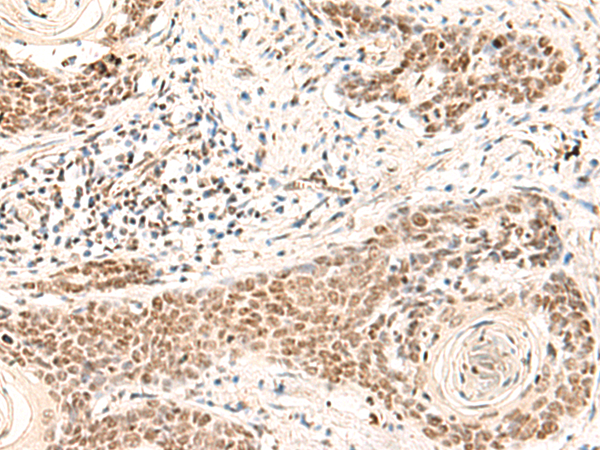 Rabbit Polyclonal Antibody to HOXD9