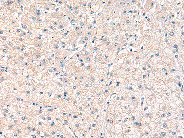 Rabbit Polyclonal Antibody to HPR