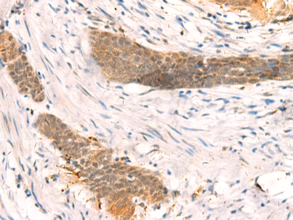 Rabbit Polyclonal Antibody to SETD1A
