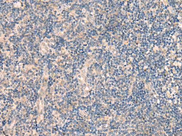 Rabbit Polyclonal Antibody to HSH2D