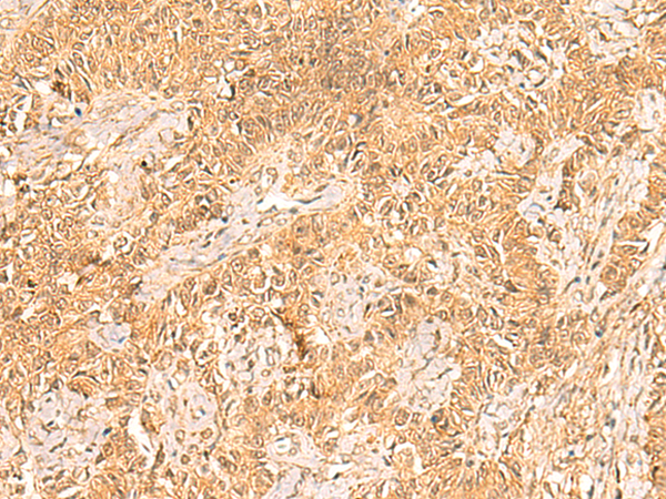 Rabbit Polyclonal Antibody to TRMT112