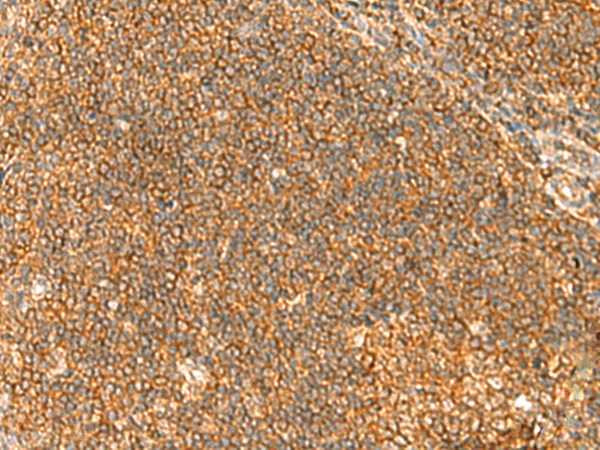 Rabbit Polyclonal Antibody to TBCK