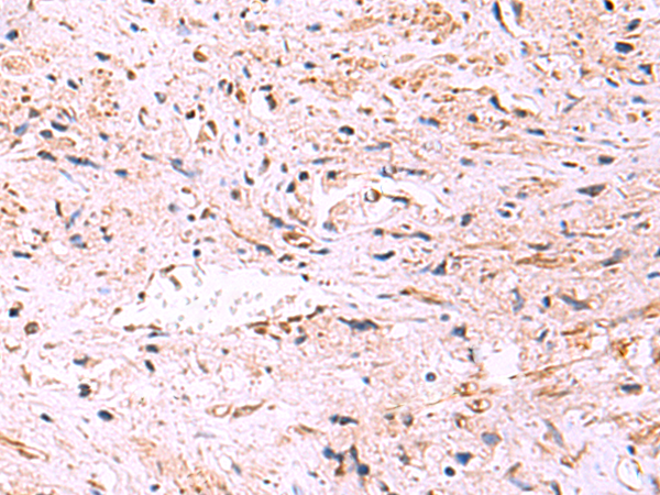 Rabbit Polyclonal Antibody to HTRA4