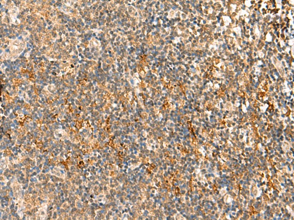 Rabbit Polyclonal Antibody to HTT