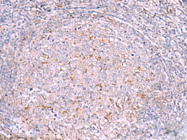 Rabbit Polyclonal Antibody to RNF217