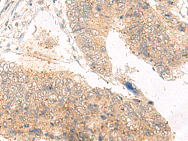 Rabbit Polyclonal Antibody to IDUA