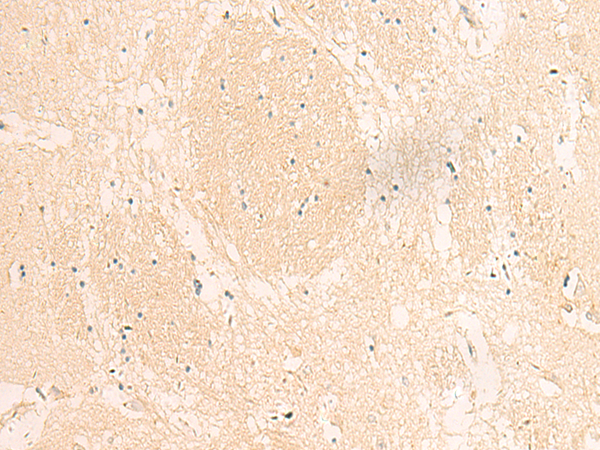 Rabbit Polyclonal Antibody to MTIF2