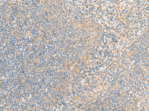 Rabbit Polyclonal Antibody to IFNA5