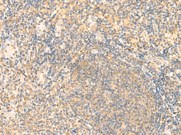 Rabbit Polyclonal Antibody to IGFBPL1